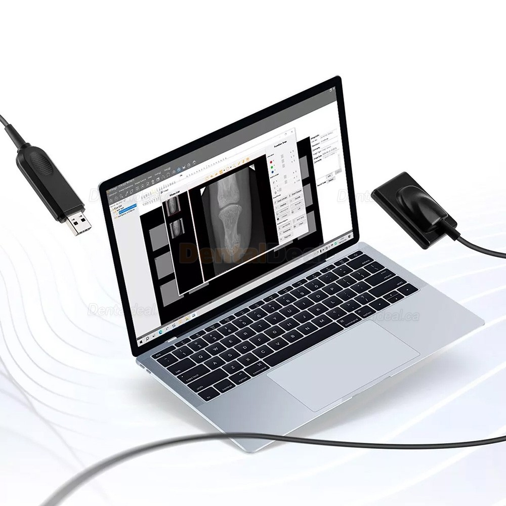 Portable Dental X-Ray Machine Handheld XRay Unit + 2230 / 2635 Dental Intraoral RVG Sensor